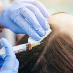 Revitalize Your Skin Naturally: The Power of PRP Therapy